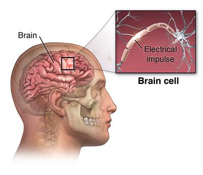 Read more about the article Epilepsy vs Seizure: What’s the Difference?
